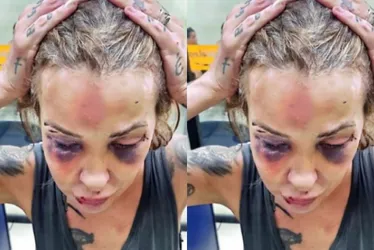 Imagem ilustrativa da imagem Justiça condena ex-namorado de jornalista por tentativa de feminicídio
