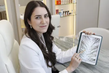 Imagem ilustrativa da imagem Médica revela sinais da alopecia em mulheres
