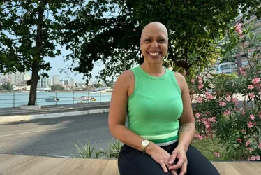 Imagem ilustrativa da imagem Médica revela sinais da alopecia em mulheres