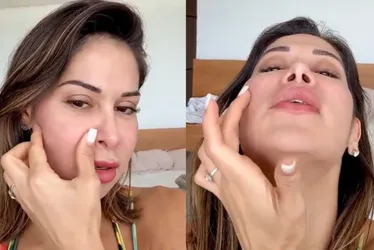 Imagem ilustrativa da imagem Médicos explicam riscos da técnica de beleza perigosa utilizada por Maíra Cardi