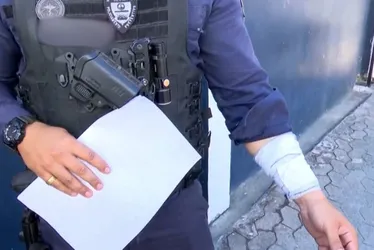 Imagem ilustrativa da imagem Pitbull ataca guarda municipal da Serra durante prisão de suspeito