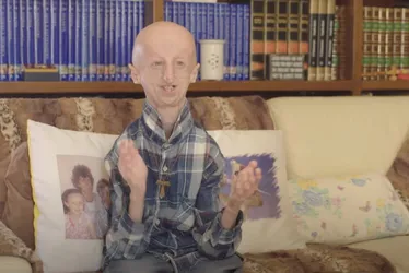 Imagem ilustrativa da imagem Progeria, a doença do envelhecimento precoce, tem cura? Conheça o quadro