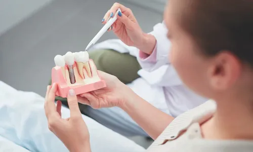 
          Imagem ilustrativa da imagem Empréstimo e até 13º salário para pagar implante dentário
          