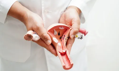 
          Imagem ilustrativa da imagem Hospital das Clínicas faz 1º transplante de útero entre pacientes vivas
          