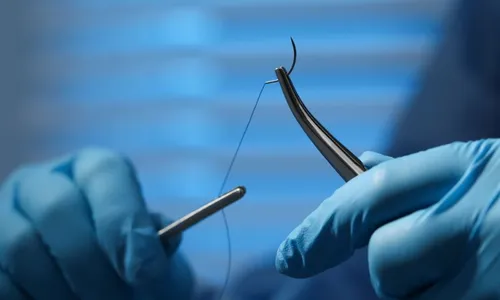 
          Imagem ilustrativa da imagem Mãe busca respostas após filho de 6 anos levar corte profundo em escola do Recife
          