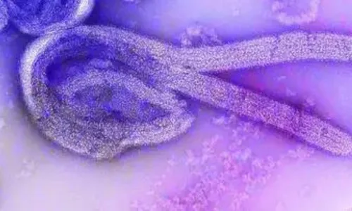 
          Imagem ilustrativa da imagem Marburg: entenda vírus com potencial pandêmico que preocupa a África
          