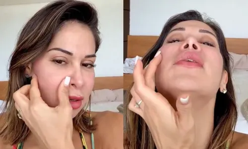 
          Imagem ilustrativa da imagem Médicos explicam riscos da técnica de beleza perigosa utilizada por Maíra Cardi
          