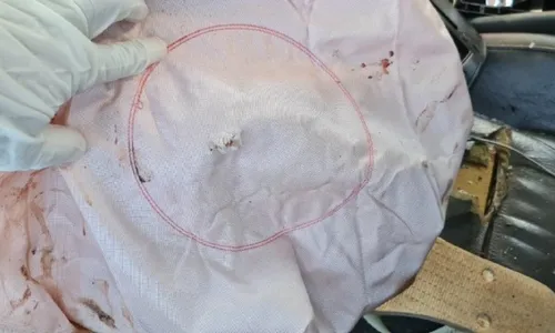 
          Imagem ilustrativa da imagem Perícia revela falha no airbag em acidente que matou motorista em Vila Velha
          