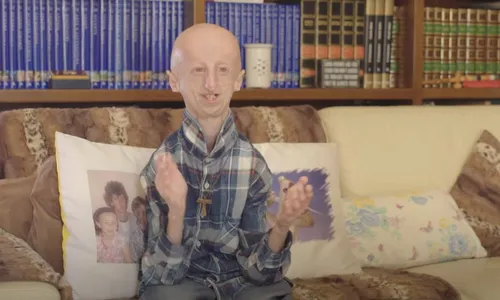 
          Imagem ilustrativa da imagem Progeria, a doença do envelhecimento precoce, tem cura? Conheça o quadro
          