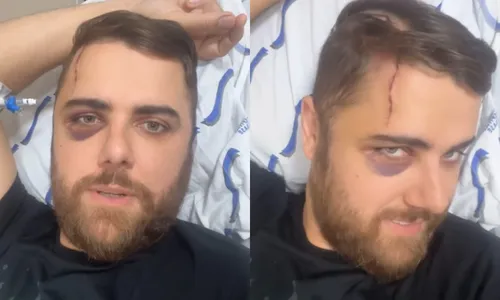 
          Imagem ilustrativa da imagem Zé Neto atualiza estado de saúde e mostra hematoma no olho após acidente
          