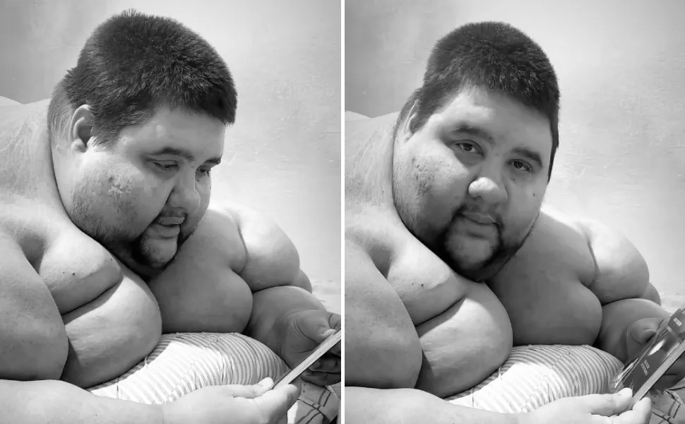 Imagem ilustrativa da imagem Morre influenciador que já pesou 380kg e comoveu com luta para emagrecer