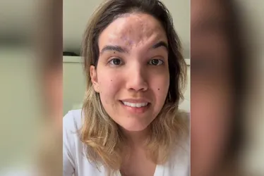 Imagem ilustrativa da imagem Condenado a 19 anos de prisão por afundar crânio de advogada com paralelepípedo