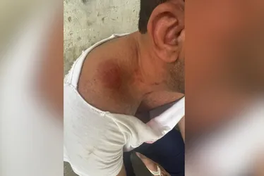Imagem ilustrativa da imagem Empresário preso por agredir ex-companheiro na Ilha do Boi se manifesta
