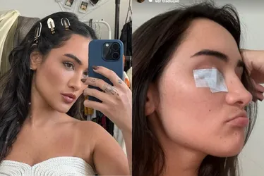 Imagem ilustrativa da imagem Gabi Melim é diagnosticada com doença que deixa face paralisada: 'vista não fecha'