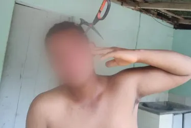 Imagem ilustrativa da imagem Homem leva tesourada na cabeça ao separar briga de irmãs no ES