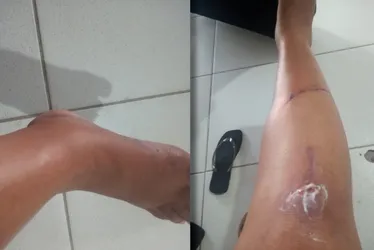 Imagem ilustrativa da imagem Pai e filho suspeitos de sequestro e cárcere contra mulheres no ES