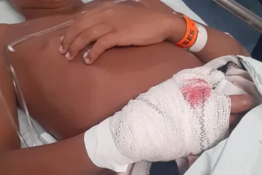 Imagem ilustrativa da imagem VÍDEO: bomba explode na sede do Sport e atinge aluno de escolinha de futsal