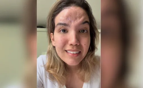 
          Imagem ilustrativa da imagem Advogada atingida por pedra revela perda de visão permanente
          