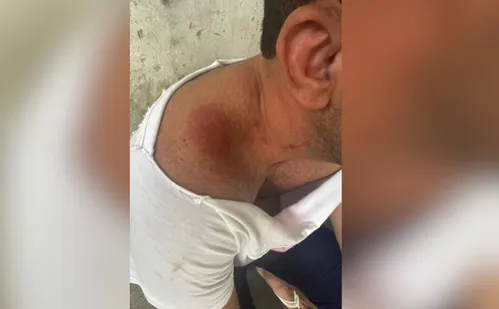 
          Imagem ilustrativa da imagem Empresário preso por agredir ex-companheiro na Ilha do Boi se manifesta
          