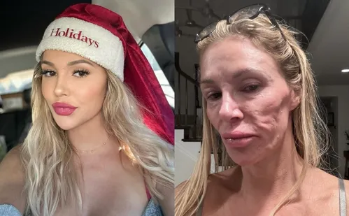 
          Imagem ilustrativa da imagem Ex-modelo mostra rosto 'derretido': 'Médicos dizem que tem um parasita'
          