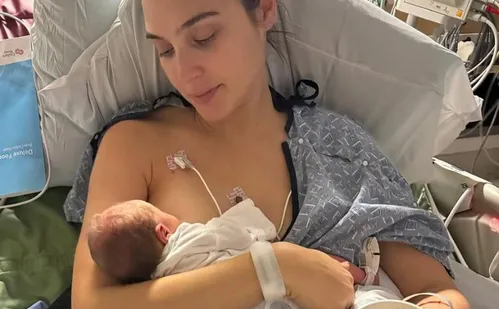 
          Imagem ilustrativa da imagem Gal Gadot passou por cirurgia para remover coágulo no cérebro durante gravidez
          