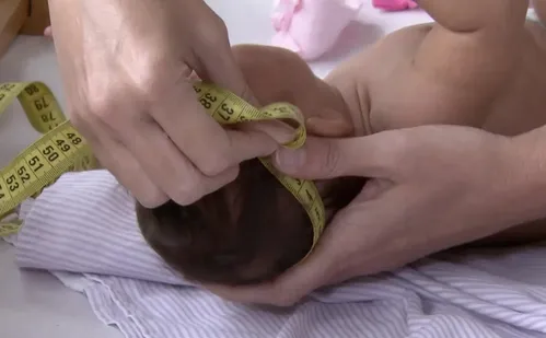 
          Imagem ilustrativa da imagem Governo pagará R$ 60 mil a famílias de crianças afetadas pelo Zika
          