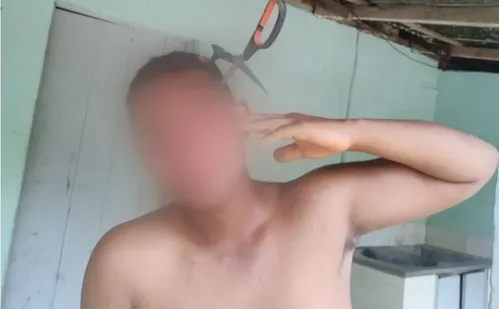 
          Imagem ilustrativa da imagem Homem leva tesourada na cabeça ao separar briga de irmãs no ES
          