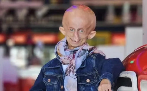 
          Imagem ilustrativa da imagem Morre Beandri Booysen, influenciadora do TikTok com doença rara, aos 19 anos
          