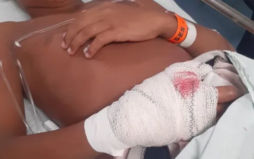 
          Imagem ilustrativa da imagem VÍDEO: bomba explode na sede do Sport e atinge aluno de escolinha de futsal
          