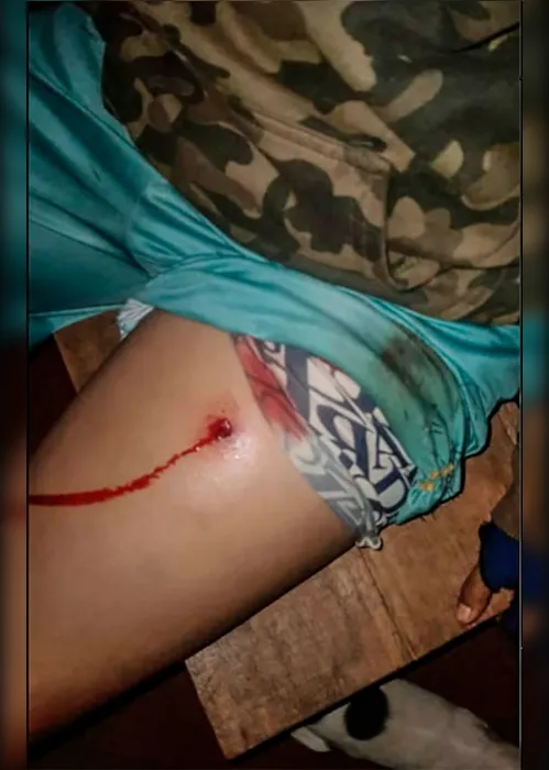 Imagem ilustrativa da imagem Justiça determina reforço de segurança em área onde indígenas foram baleados no Paraná