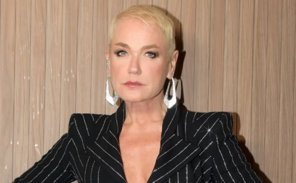 Imagem ilustrativa da imagem Xuxa fala sobre pouco cabelo e revela que tem alopecia androgenética