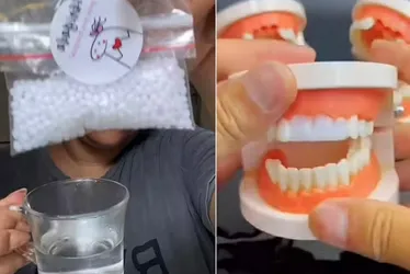 Imagem ilustrativa da imagem “Dente da Shopee” vendido a R$ 20 oferece perigo?