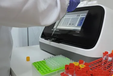 Imagem ilustrativa da imagem ES vai receber 268 mil testes rápidos para diagnosticar dengue