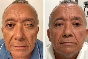 Imagem ilustrativa da imagem Pioneira: médica de Pernambuco revoluciona vidas com tatuagem ocular