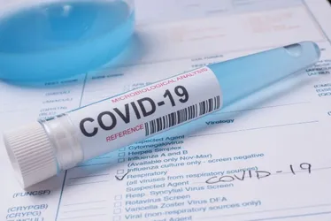 Imagem ilustrativa da imagem Primeiro óbito por Covid em Pernambuco em 2025: alerta para a vigilância sanitária