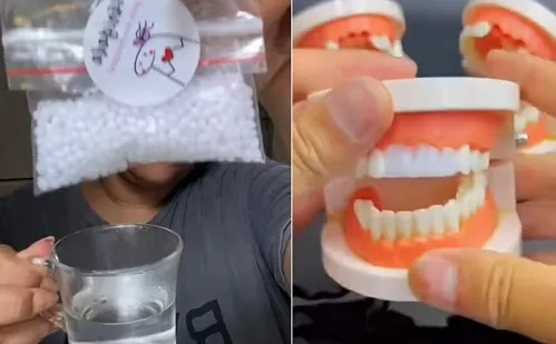 
          Imagem ilustrativa da imagem “Dente da Shopee” vendido a R$ 20 oferece perigo?
          