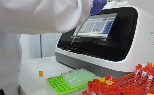 
          Imagem ilustrativa da imagem ES vai receber 268 mil testes rápidos para diagnosticar dengue
          