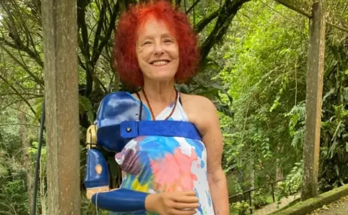 
          Imagem ilustrativa da imagem Escritora que perdeu braço após ataque de pitbulls comemora uso de prótese biônica
          