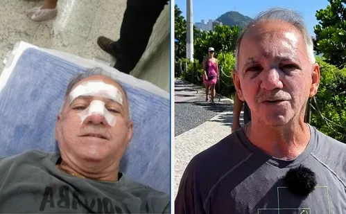 
          Imagem ilustrativa da imagem Homem é atropelado por patinete elétrico em ciclovia de Vila Velha
          