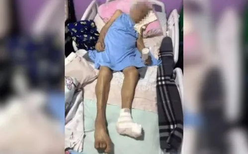 
          Imagem ilustrativa da imagem Idosa de 103 anos tem o pé amputado em casa e sem anestesia
          