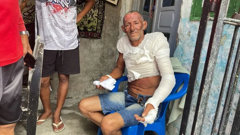 Imagem ilustrativa da imagem Botijão de gás explode no bairro do Barro e família pede ajuda