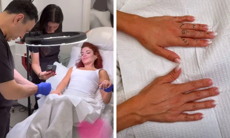 Imagem ilustrativa da imagem Gkay faz harmonização das mãos com médico das celebridades em Los Angeles