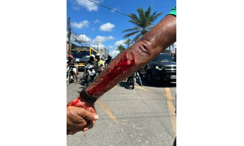 Imagem ilustrativa da imagem MST trata atropelamento de militantes, no Recife, como crime político
