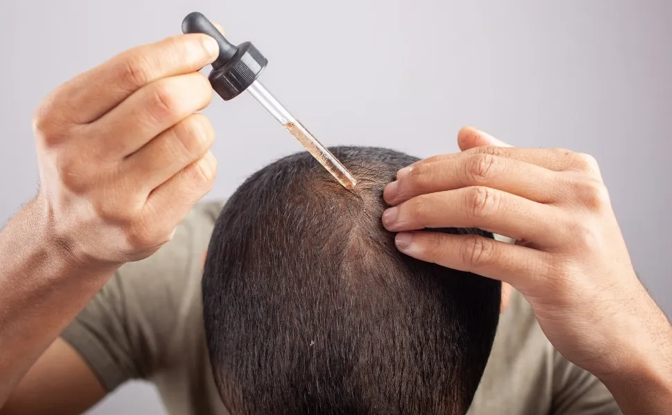 Imagem ilustrativa da imagem Minoxidil pode causar crescimento anormal de pelos em bebês, alerta Anvisa