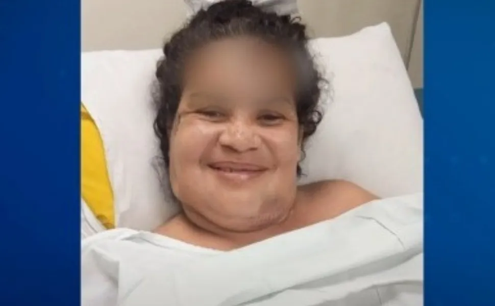Imagem ilustrativa da imagem Mulher perde parte da orelha após ser agredida pelo ex-companheiro