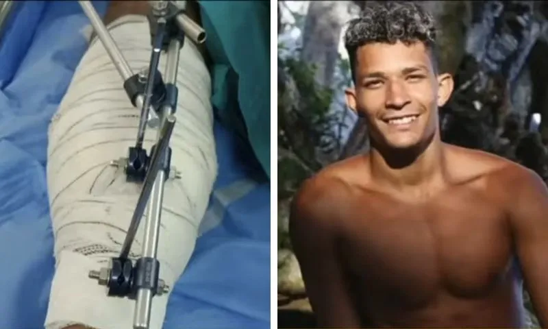 Imagem ilustrativa da imagem “Qual a dúvida de quem é a vítima?”, diz mãe de ambulante baleado por delegado