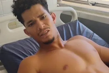 Imagem ilustrativa da imagem Ambulante baleado por delegado em Noronha passa por segunda cirurgia na perna
