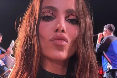 Imagem ilustrativa da imagem Anitta quer barrar uso de seu nome em remédio de vermes, diz colunista