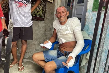 Imagem ilustrativa da imagem Botijão de gás explode no bairro do Barro e família pede ajuda