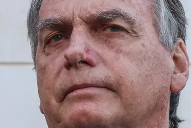 Imagem ilustrativa da imagem Equipe médica de Bolsonaro descarta complicações pós-cirúrgicas